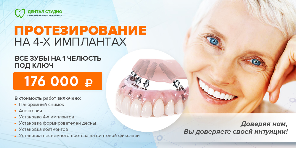 Несъемное протезирование на 4-х имплантах