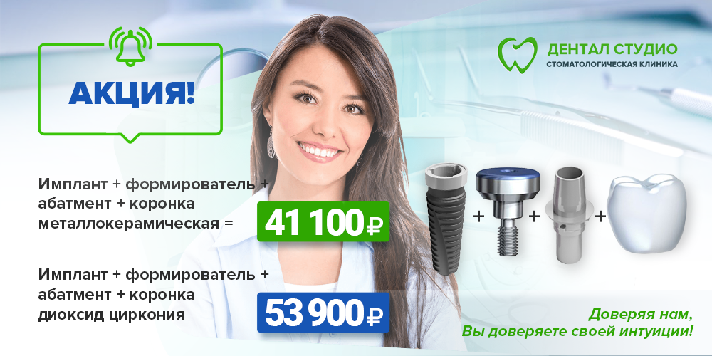 Акция "Имплантация зуба под ключ" Акция "Имплантация зуба под ключ"