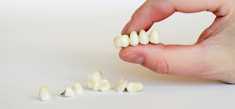 Варианты протезирования, если нет корня зуба