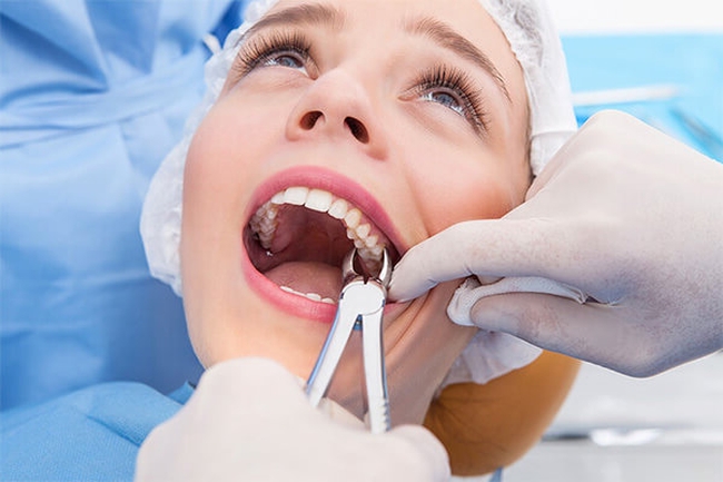 Удаление ретенированного зуба 